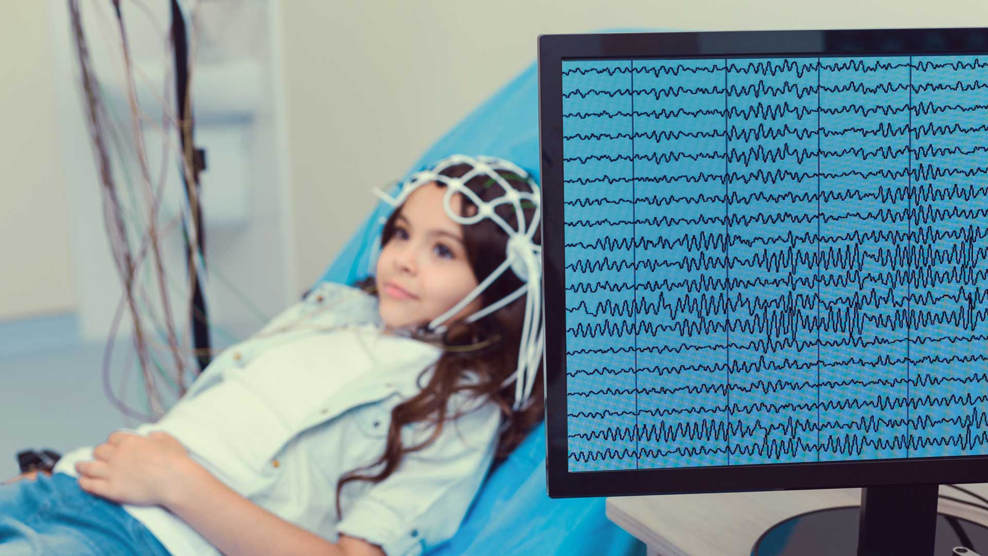 Citas con especialistas en Epileptología | Instituto Colombiano de Neurociencias